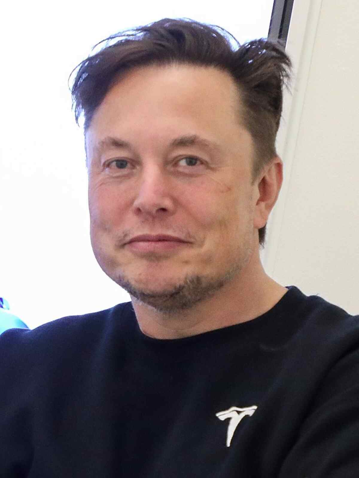 Elon Musk Before Hair Transplant