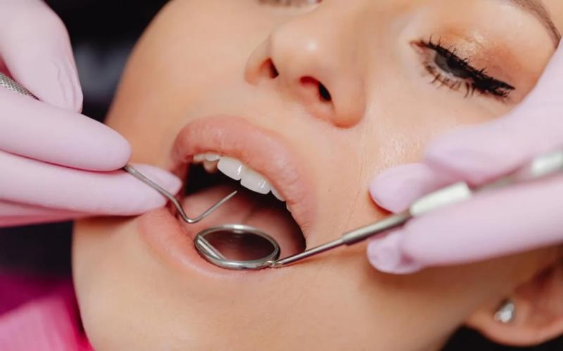 Things to Consider Before Planning Your Trip to Turkey for Cosmetic Dentistry Treatments